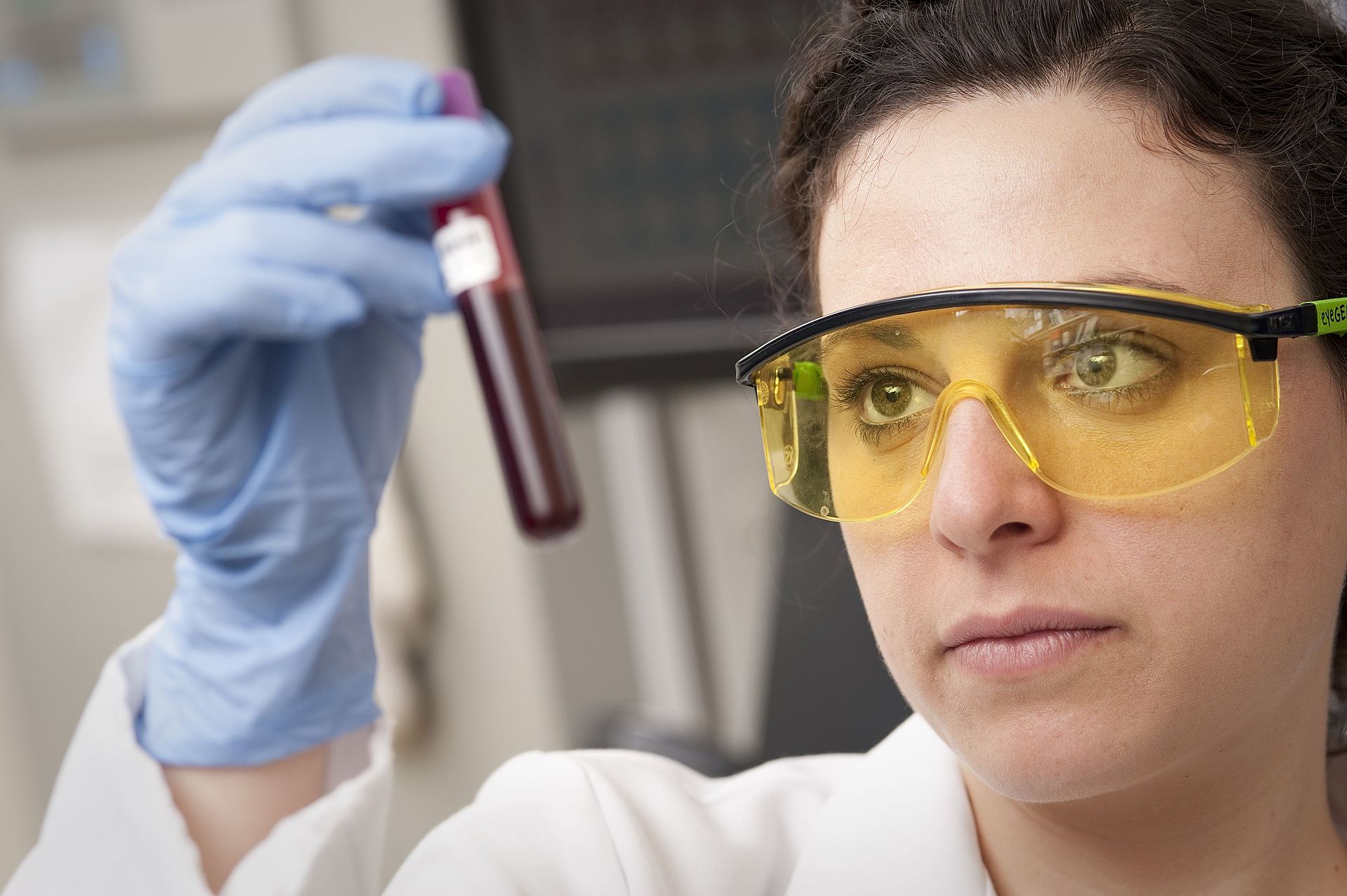The Promise and the Fine Print: What 2026 Taught Us About Catching Cancer in a Drop of Blood | AVALW News